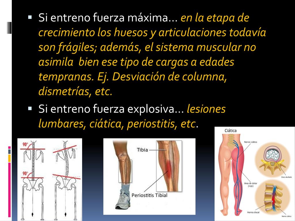 Si entreno fuerza máxima… en la etapa de crecimiento los huesos y articulaciones todavía son frágiles; además, el sistema muscular no asimila bien ese tipo de cargas a edades tempranas. Ej. Desviación de columna, dismetrías, etc.