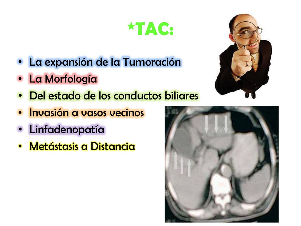 *TAC: La expansión de la Tumoración La Morfología