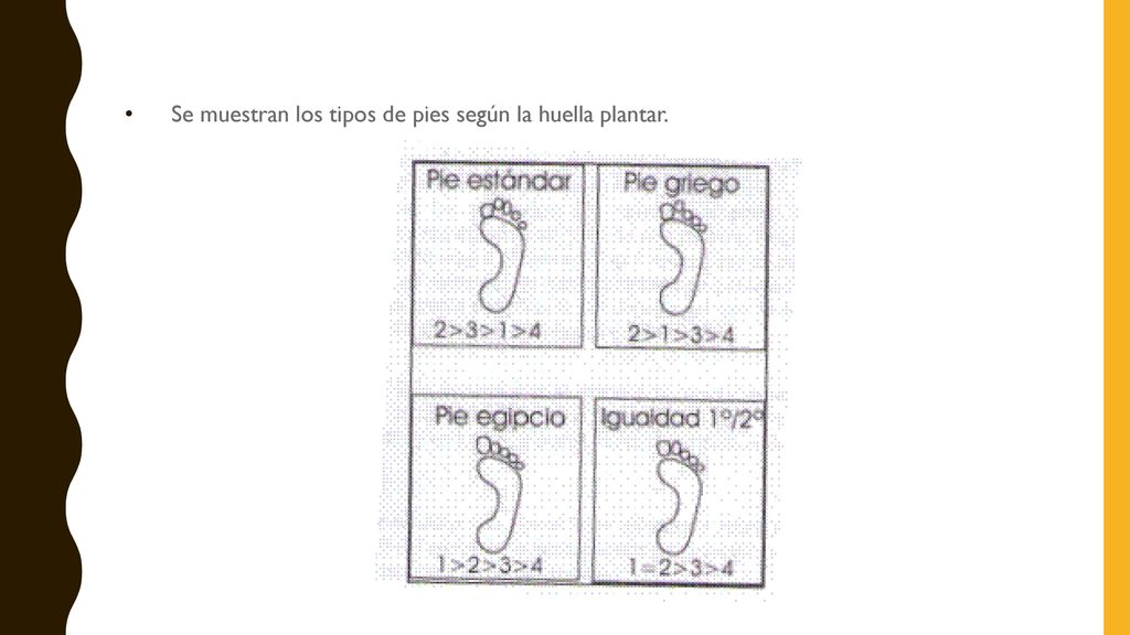 Se muestran los tipos de pies según la huella plantar.