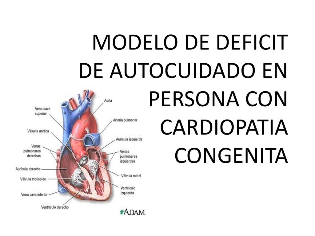 MODELO DE DEFICIT DE AUTOCUIDADO EN PERSONA CON CARDIOPATIA CONGENITA