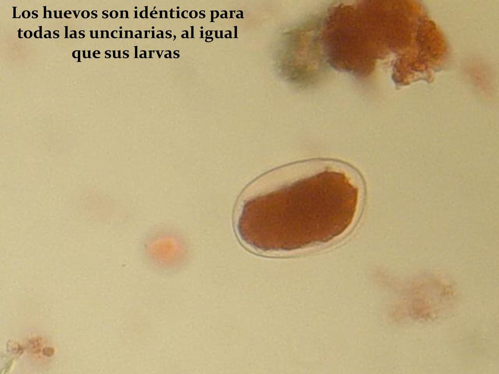 Los huevos son idénticos para todas las uncinarias, al igual que sus larvas