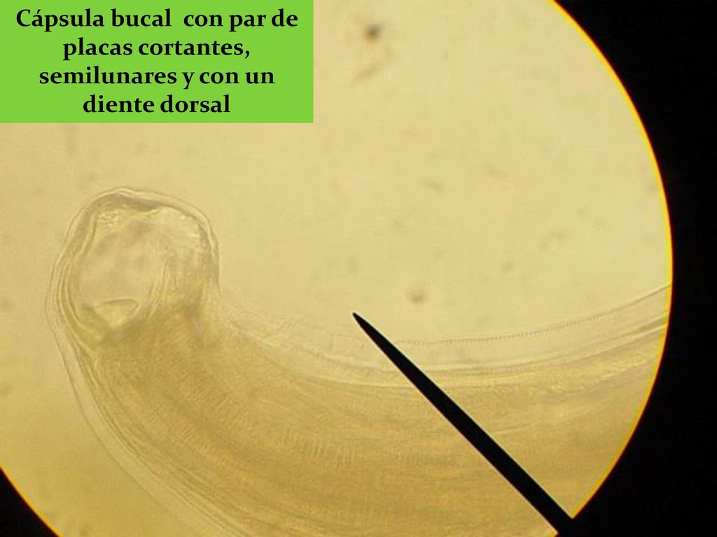 Cápsula bucal con par de placas cortantes, semilunares y con un diente dorsal