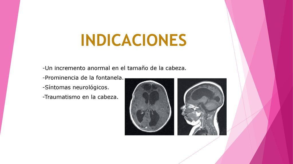 INDICACIONES -Un incremento anormal en el tamaño de la cabeza.
