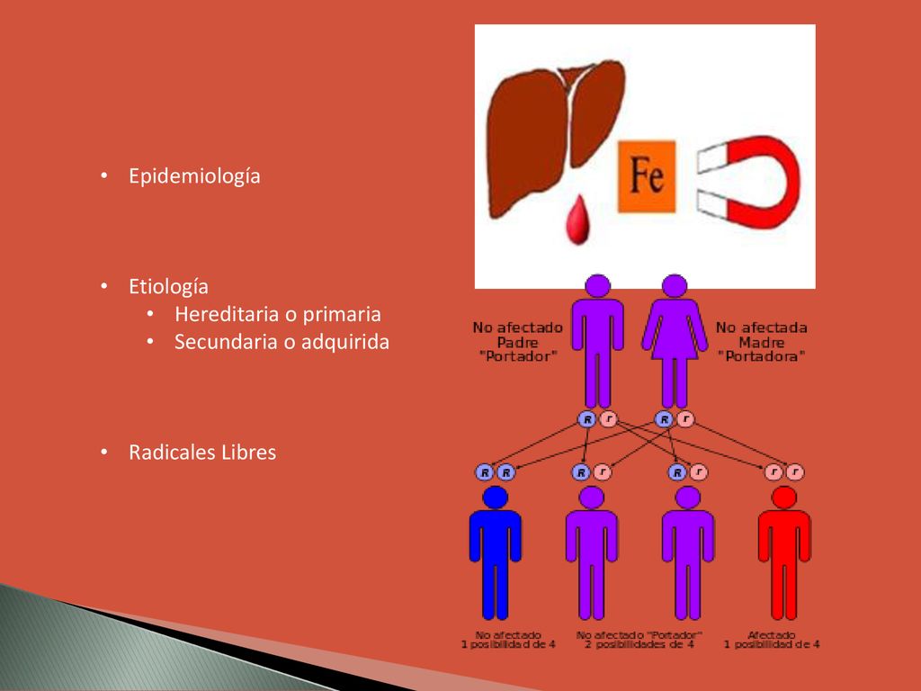 Epidemiología Etiología Hereditaria o primaria Secundaria o adquirida Radicales Libres