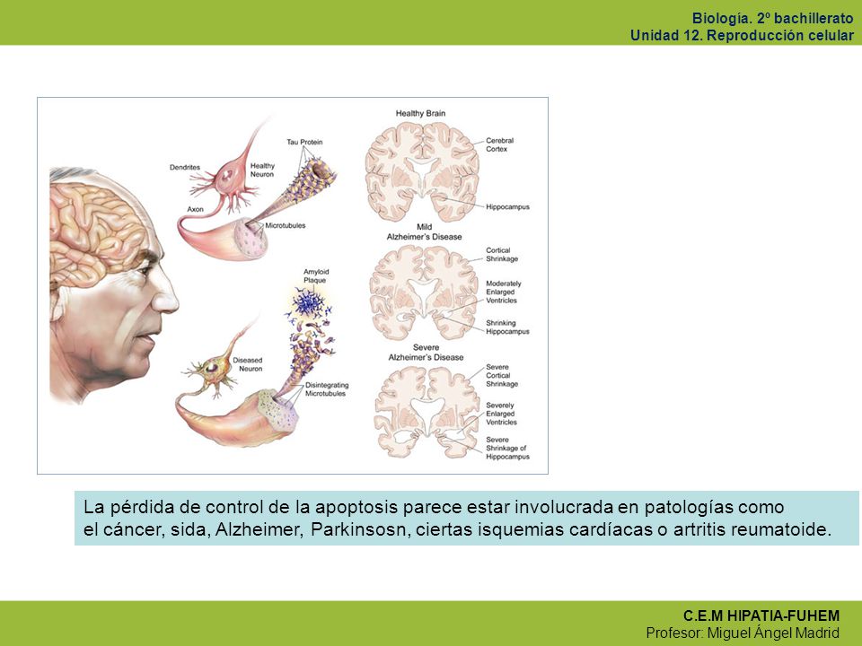 La pérdida de control de la apoptosis parece estar involucrada en patologías como