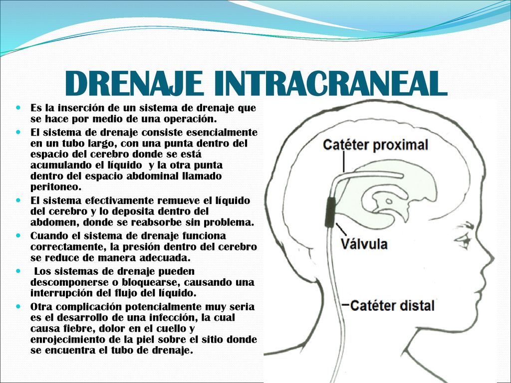 DRENAJE INTRACRANEAL Es la inserción de un sistema de drenaje que se hace por medio de una operación.