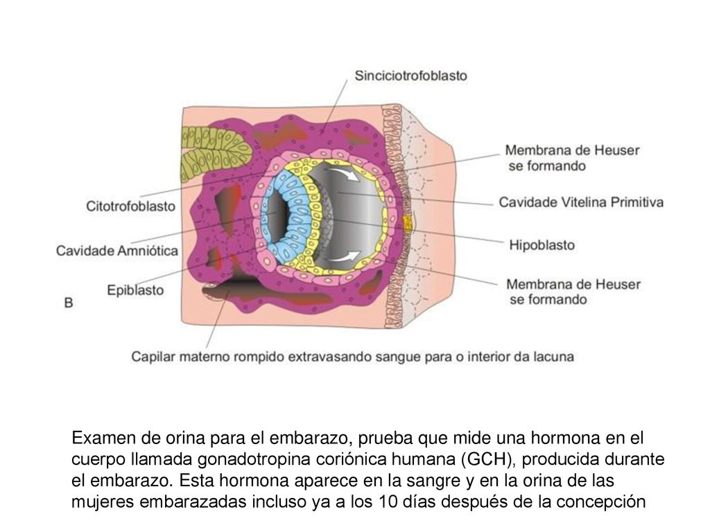 Examen de orina para el embarazo, prueba que mide una hormona en el cuerpo llamada gonadotropina coriónica humana (GCH), producida durante el embarazo.