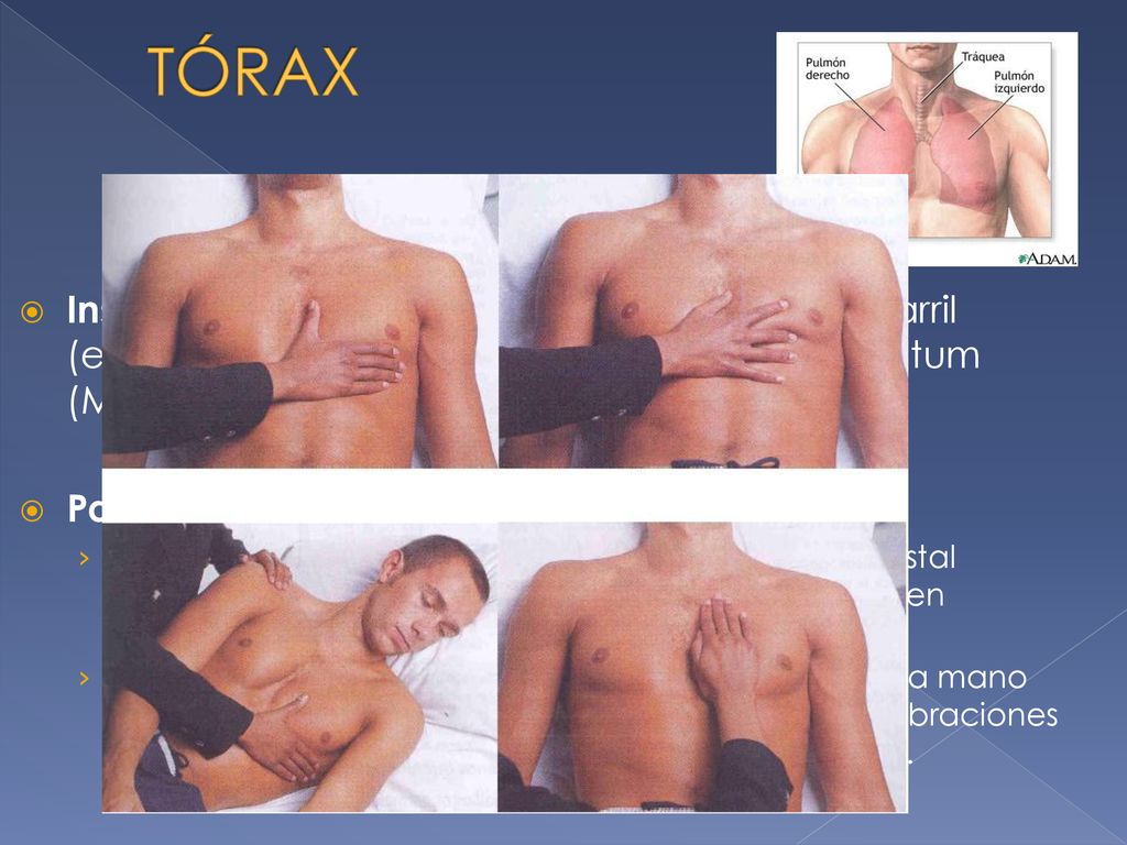 TÓRAX Inspección→forma de la caja torácica: en barril (enfisema), pectus excavatum, pectus carinatum (Marfan), cifoescoliosis.