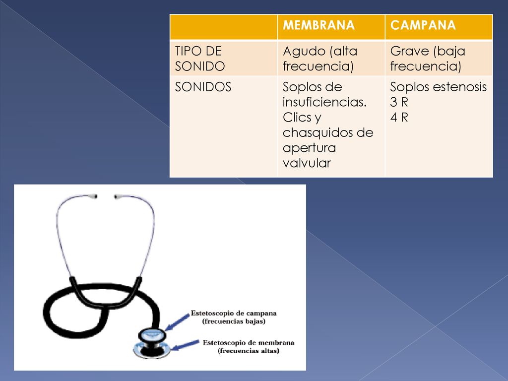 MEMBRANA CAMPANA. TIPO DE SONIDO. Agudo (alta frecuencia) Grave (baja frecuencia) SONIDOS.