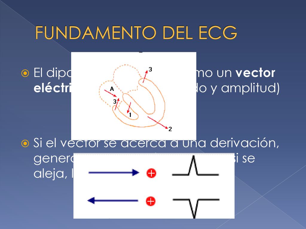 FUNDAMENTO DEL ECG El dipolo se representa como un vector eléctrico (dirección, sentido y amplitud)