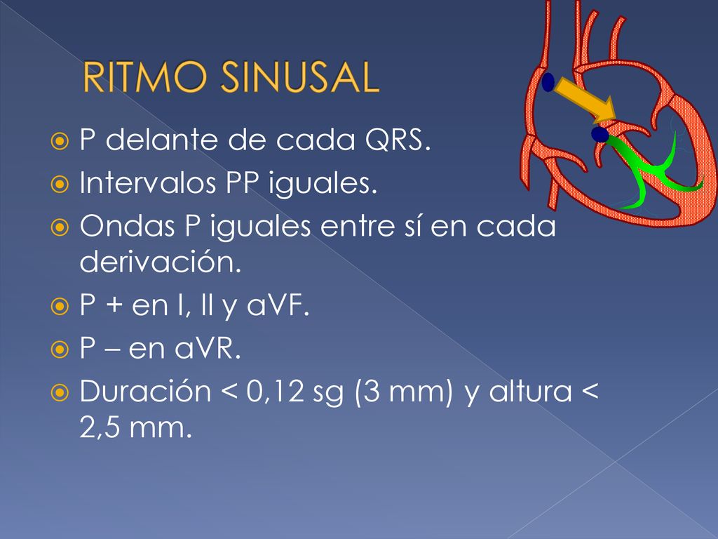 RITMO SINUSAL P delante de cada QRS. Intervalos PP iguales.