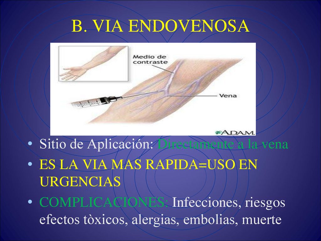 B. VIA ENDOVENOSA Sitio de Aplicación: Directamente a la vena