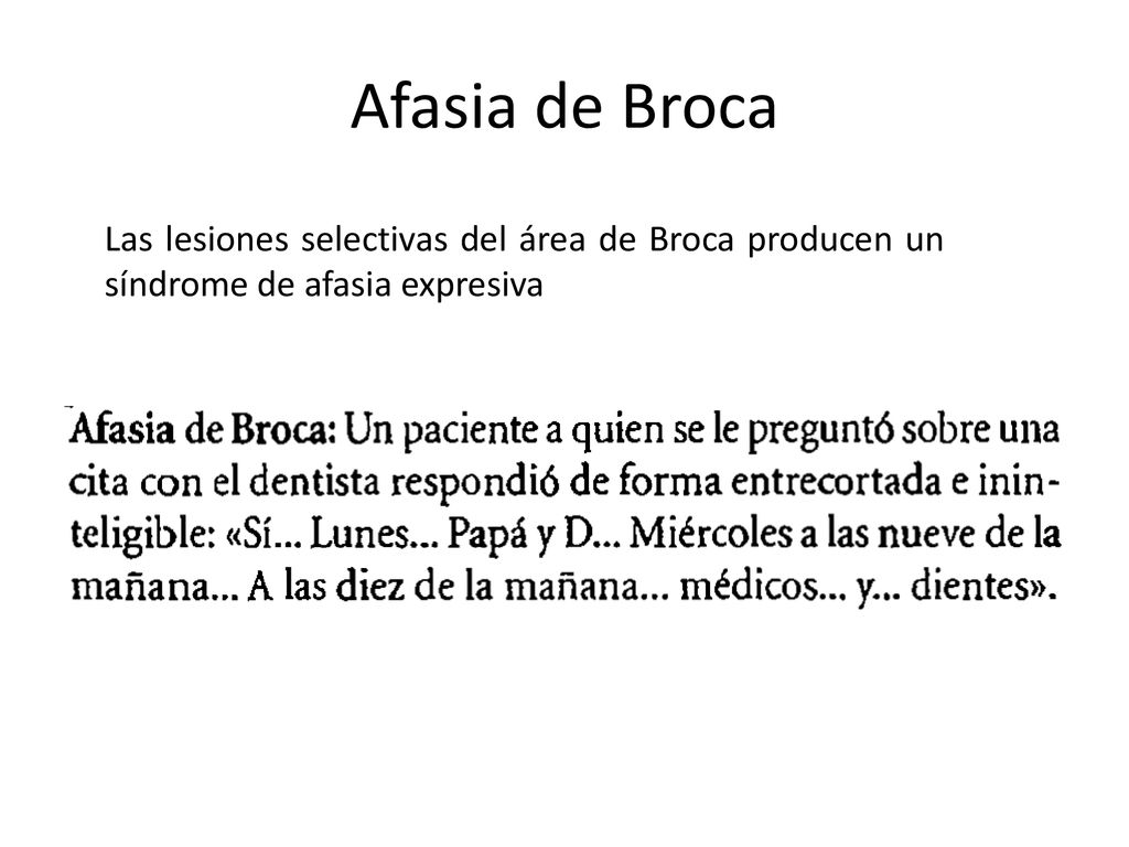 Afasia de Broca Las lesiones selectivas del área de Broca producen un síndrome de afasia expresiva