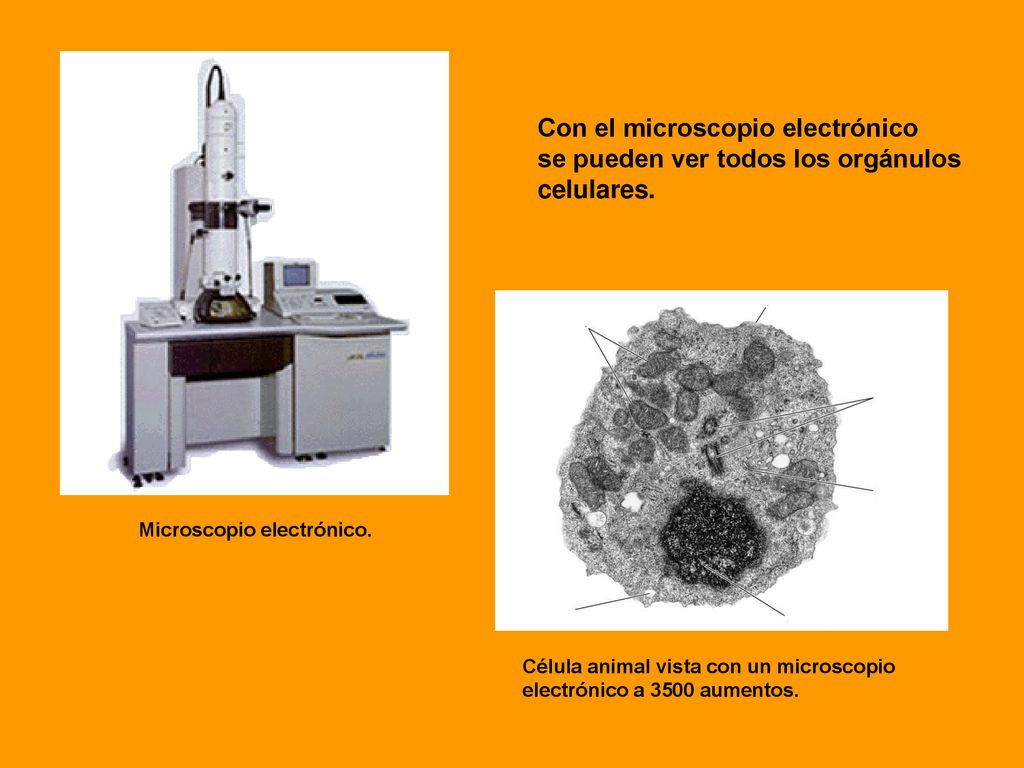 Con el microscopio electrónico se pueden ver todos los orgánulos