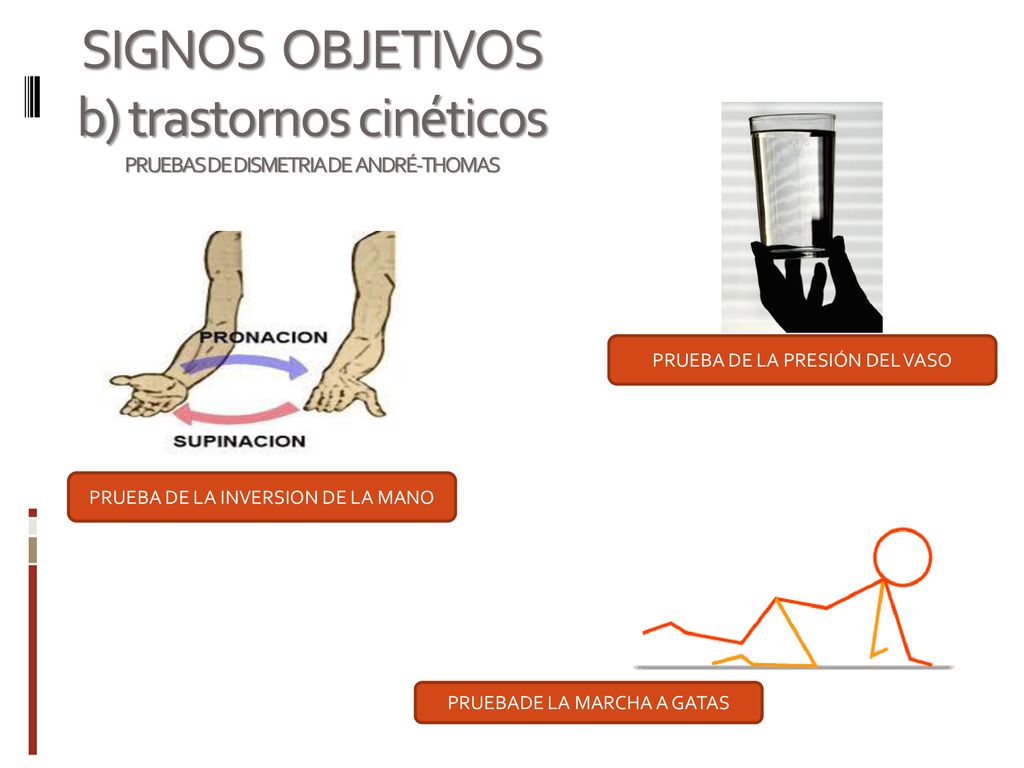 SIGNOS OBJETIVOS b) trastornos cinéticos PRUEBAS DE DISMETRIA DE ANDRÉ-THOMAS