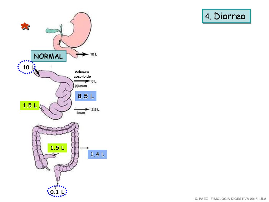 * 4. Diarrea NORMAL 8.5 L Disfunción INTESTINO Disfunción COLON 10 L