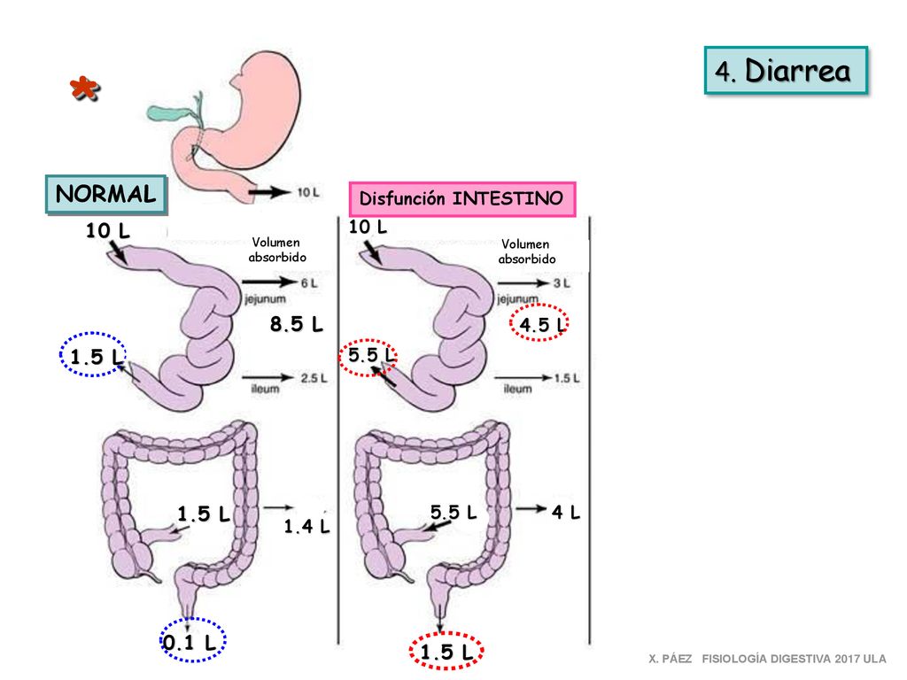 * 4. Diarrea NORMAL 10 L 8.5 L 1.5 L 1.5 L 0.1 L 1.5 L