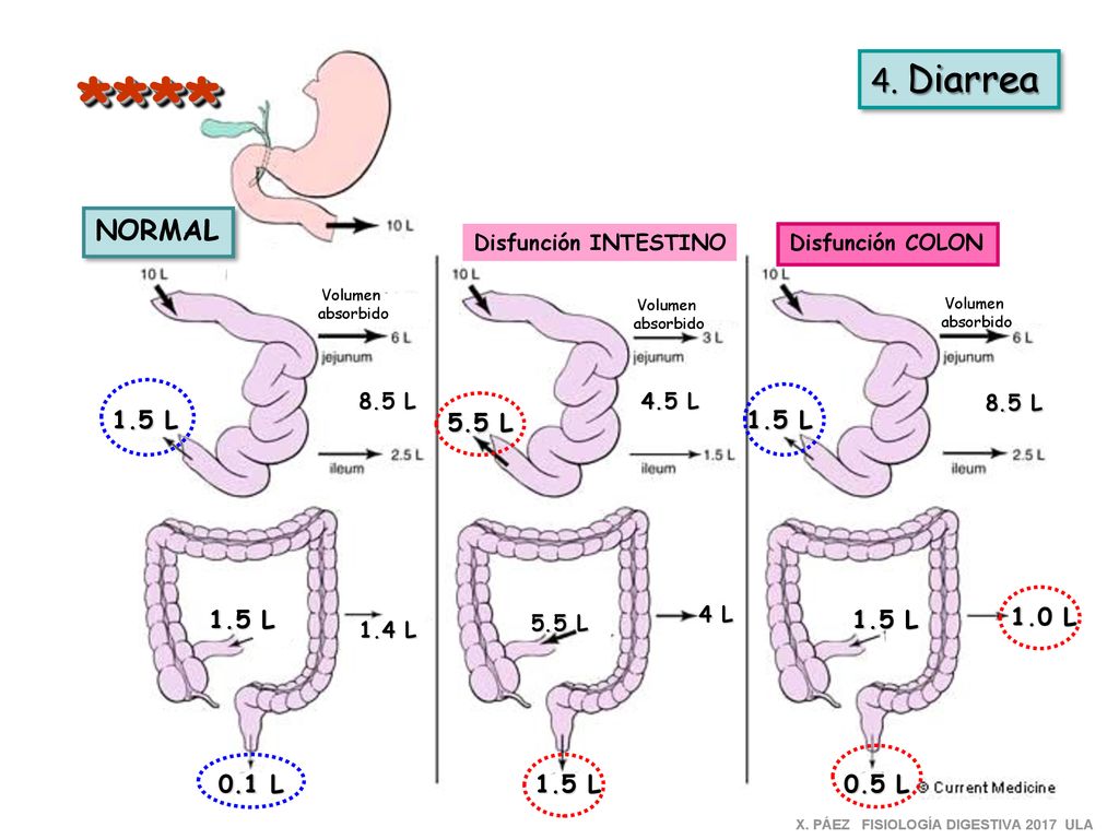 **** 4. Diarrea NORMAL 1.5 L 5.5 L 1.5 L 1.5 L 1.5 L 1.0 L 0.1 L 1.5 L