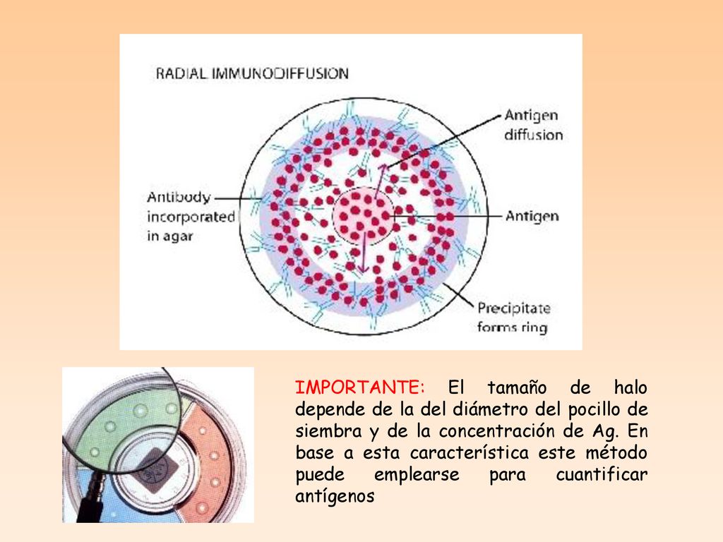 IMPORTANTE: El tamaño de halo depende de la del diámetro del pocillo de siembra y de la concentración de Ag.