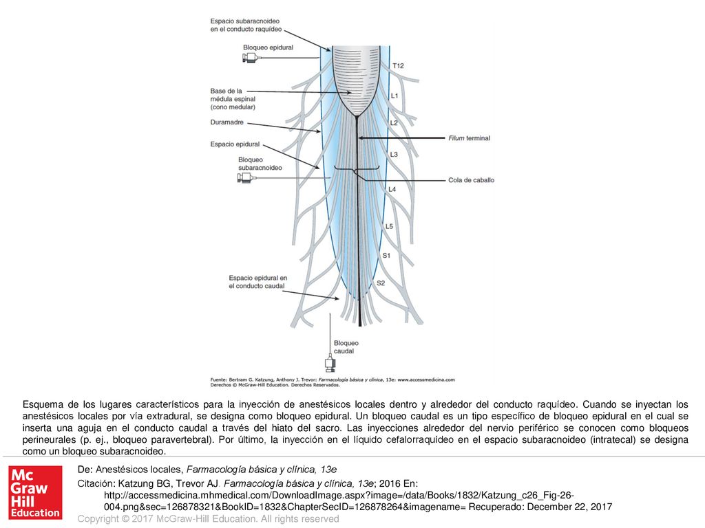 Esquema de los lugares característicos para la inyección de anestésicos locales dentro y alrededor del conducto raquídeo. Cuando se inyectan los anestésicos locales por vía extradural, se designa como bloqueo epidural. Un bloqueo caudal es un tipo específico de bloqueo epidural en el cual se inserta una aguja en el conducto caudal a través del hiato del sacro. Las inyecciones alrededor del nervio periférico se conocen como bloqueos perineurales (p. ej., bloqueo paravertebral). Por último, la inyección en el líquido cefalorraquídeo en el espacio subaracnoideo (intratecal) se designa como un bloqueo subaracnoideo.