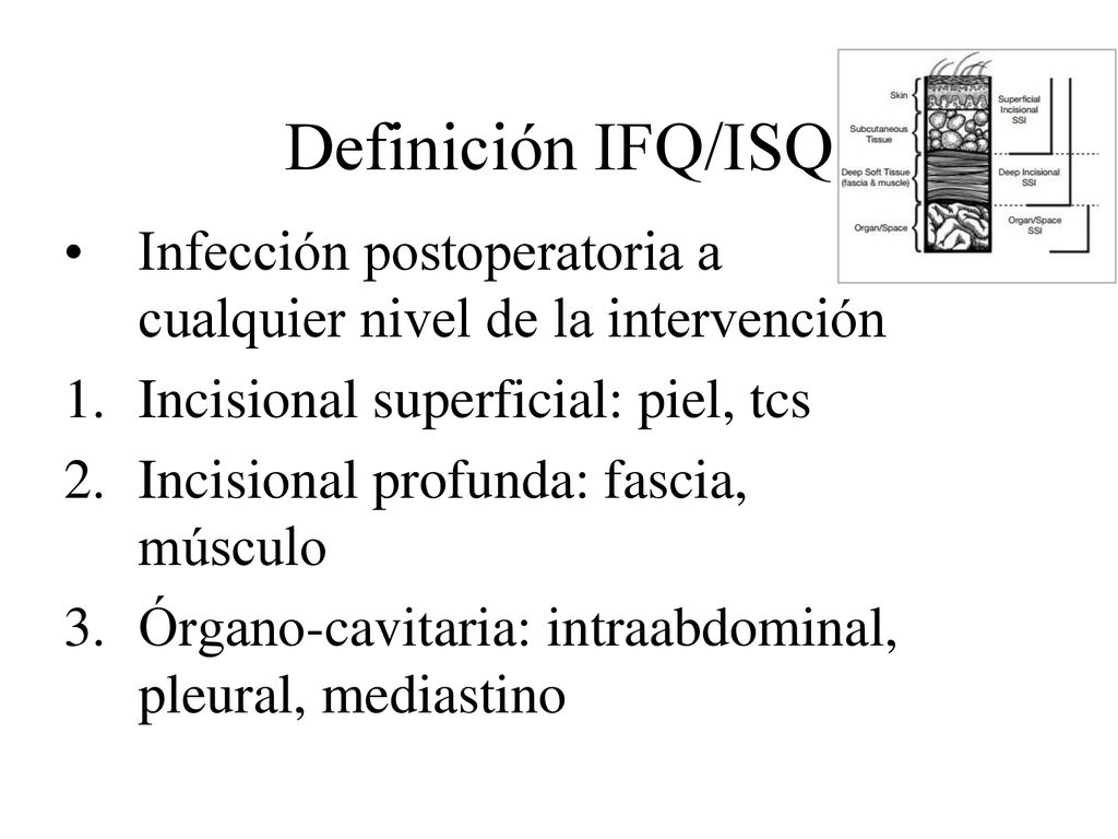 Definición IFQ/ISQ Infección postoperatoria a cualquier nivel de la intervención. Incisional superficial: piel, tcs.