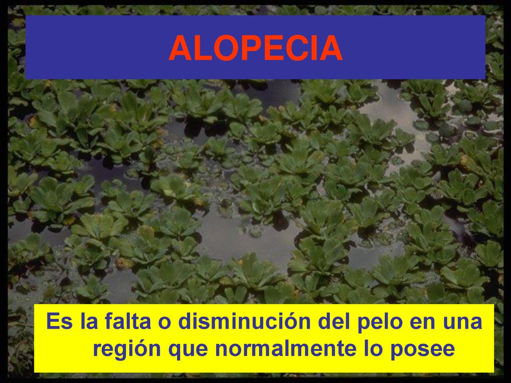 ALOPECIA Es la falta o disminución del pelo en una región que normalmente lo posee