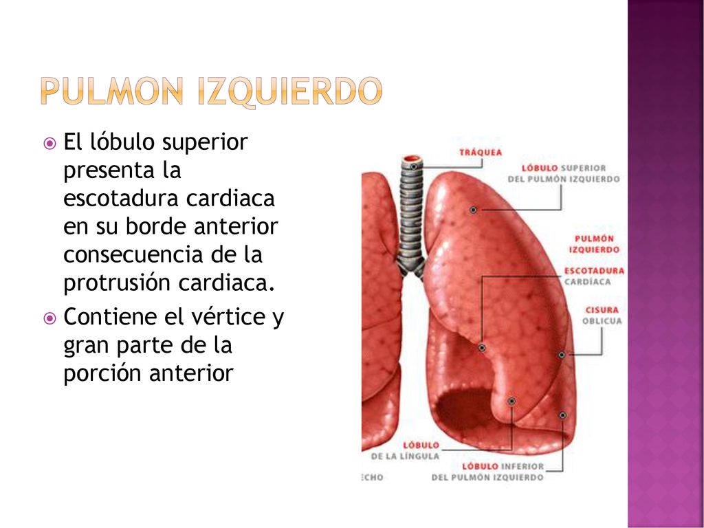 Pulmon izquierdo El lóbulo superior presenta la escotadura cardiaca en su borde anterior consecuencia de la protrusión cardiaca.
