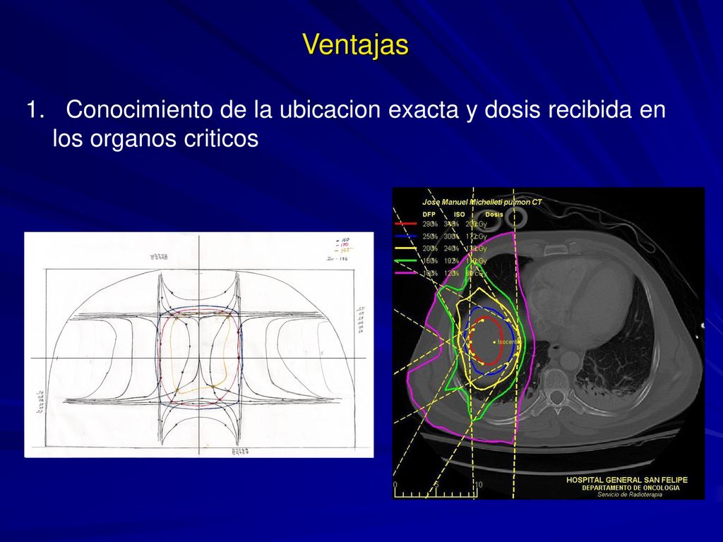 Ventajas Conocimiento de la ubicacion exacta y dosis recibida en los organos criticos