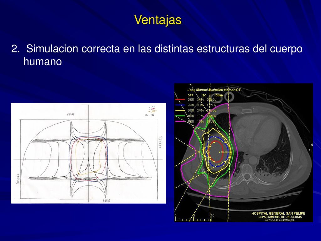 Ventajas 2. Simulacion correcta en las distintas estructuras del cuerpo humano