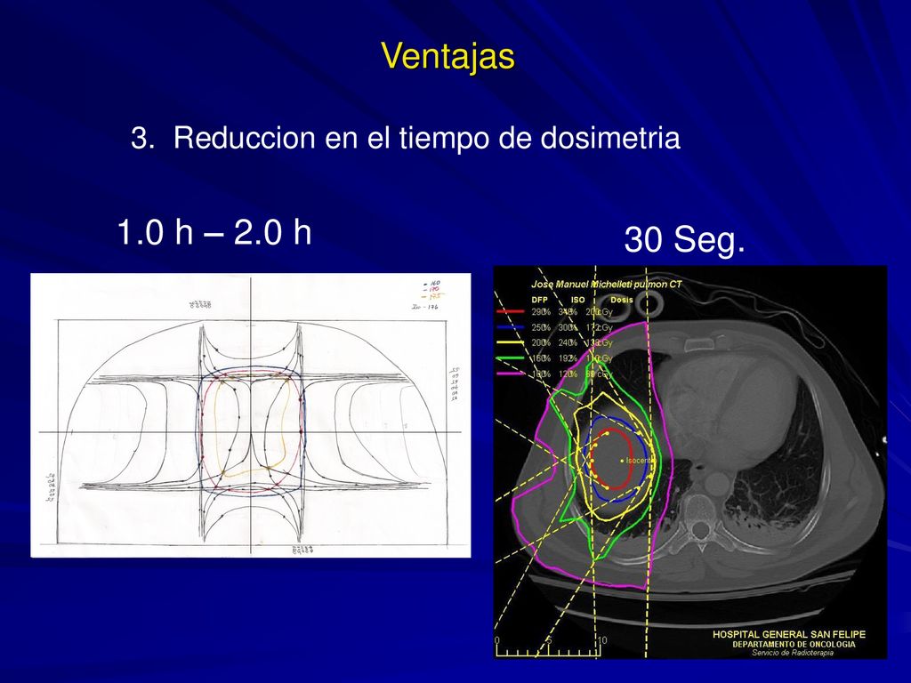 Ventajas 3. Reduccion en el tiempo de dosimetria 1.0 h – 2.0 h 30 Seg.
