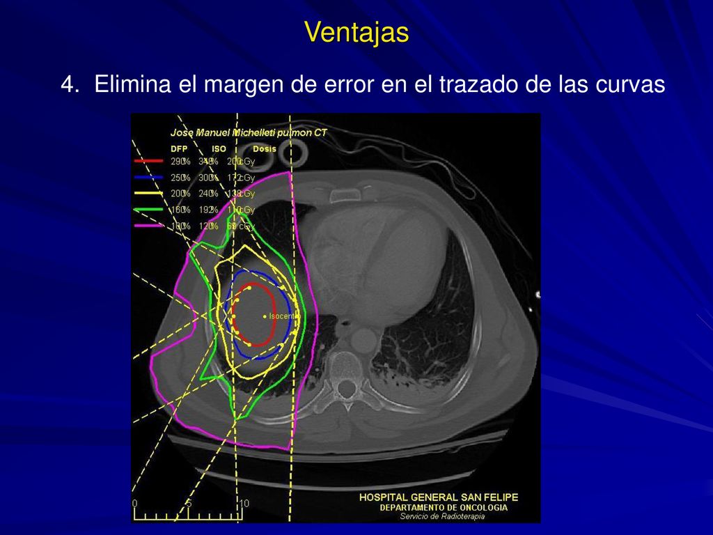 Ventajas 4. Elimina el margen de error en el trazado de las curvas