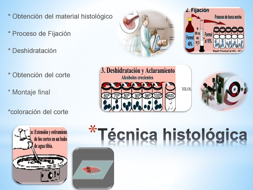 * Obtención del material histológico * Proceso de Fijación * Deshidratación * Obtención del corte * Montaje final *coloración del corte