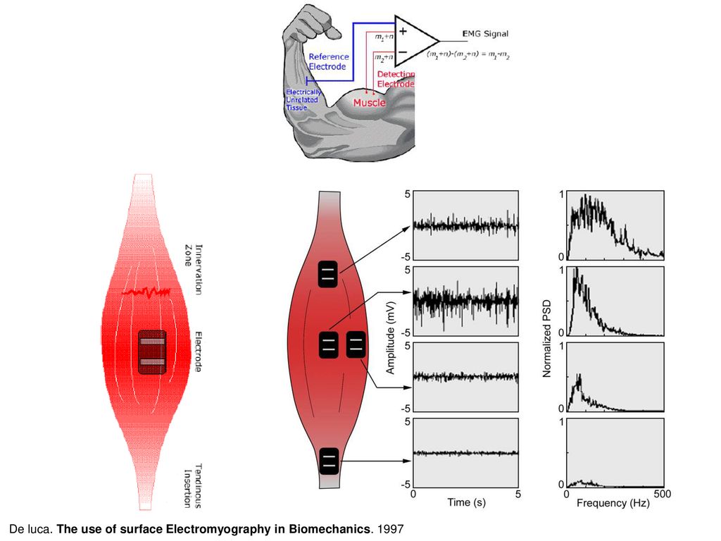 De luca. The use of surface Electromyography in Biomechanics. 1997