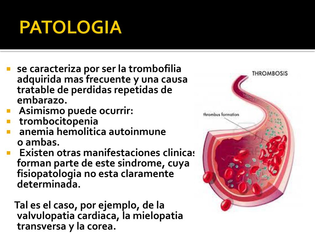 PATOLOGIA se caracteriza por ser la trombofilia adquirida mas frecuente y una causa tratable de perdidas repetidas de embarazo.