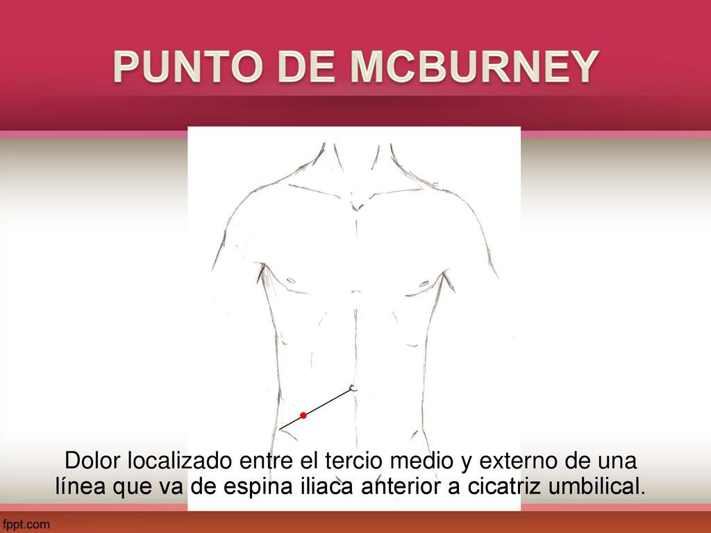 PUNTO DE MCBURNEY Dolor localizado entre el tercio medio y externo de una línea que va de espina iliaca anterior a cicatriz umbilical.