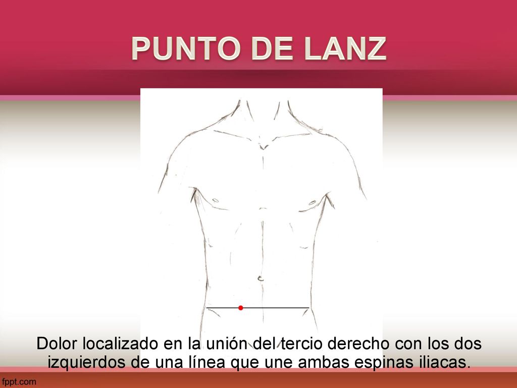 PUNTO DE LANZ Dolor localizado en la unión del tercio derecho con los dos izquierdos de una línea que une ambas espinas iliacas.