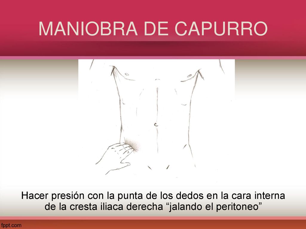 MANIOBRA DE CAPURRO Hacer presión con la punta de los dedos en la cara interna de la cresta iliaca derecha jalando el peritoneo