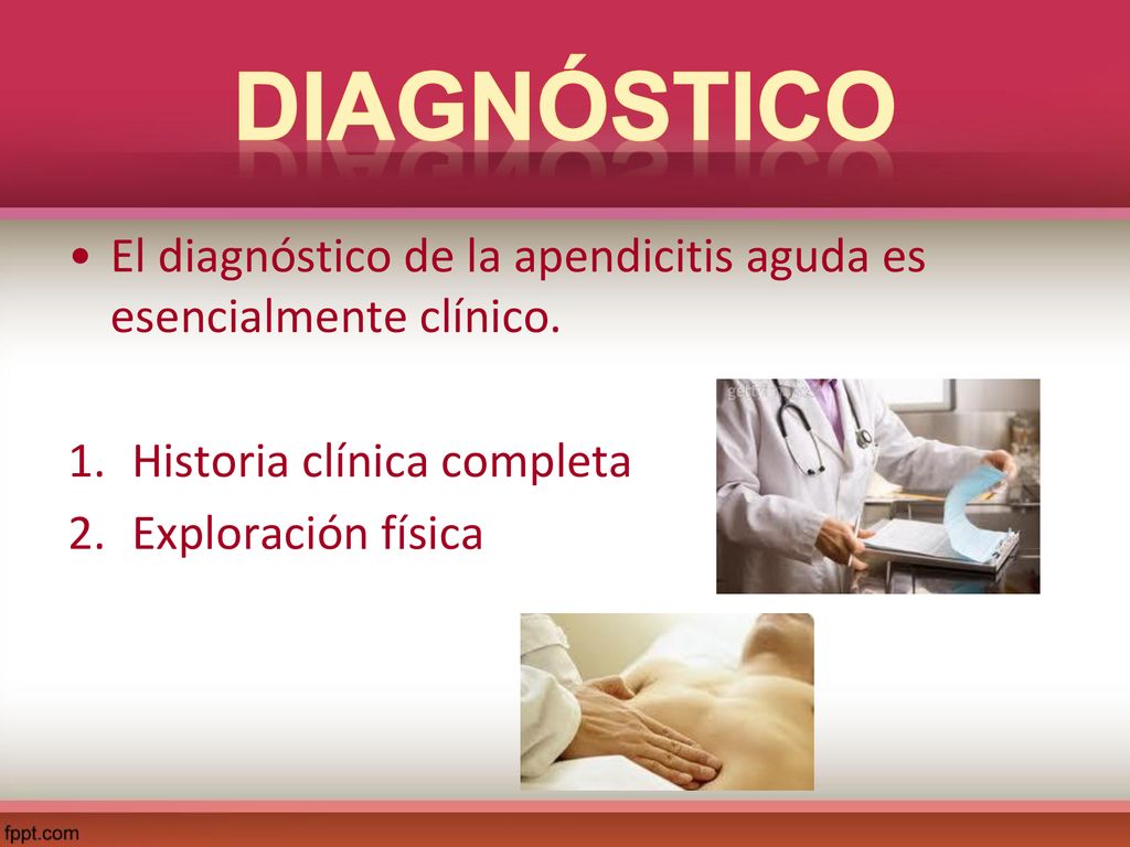 Diagnóstico El diagnóstico de la apendicitis aguda es esencialmente clínico. Historia clínica completa.