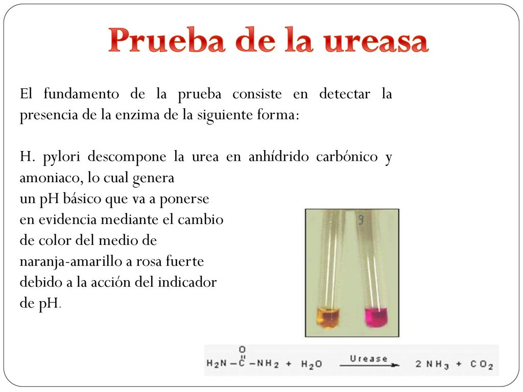 Prueba de la ureasa El fundamento de la prueba consiste en detectar la presencia de la enzima de la siguiente forma: