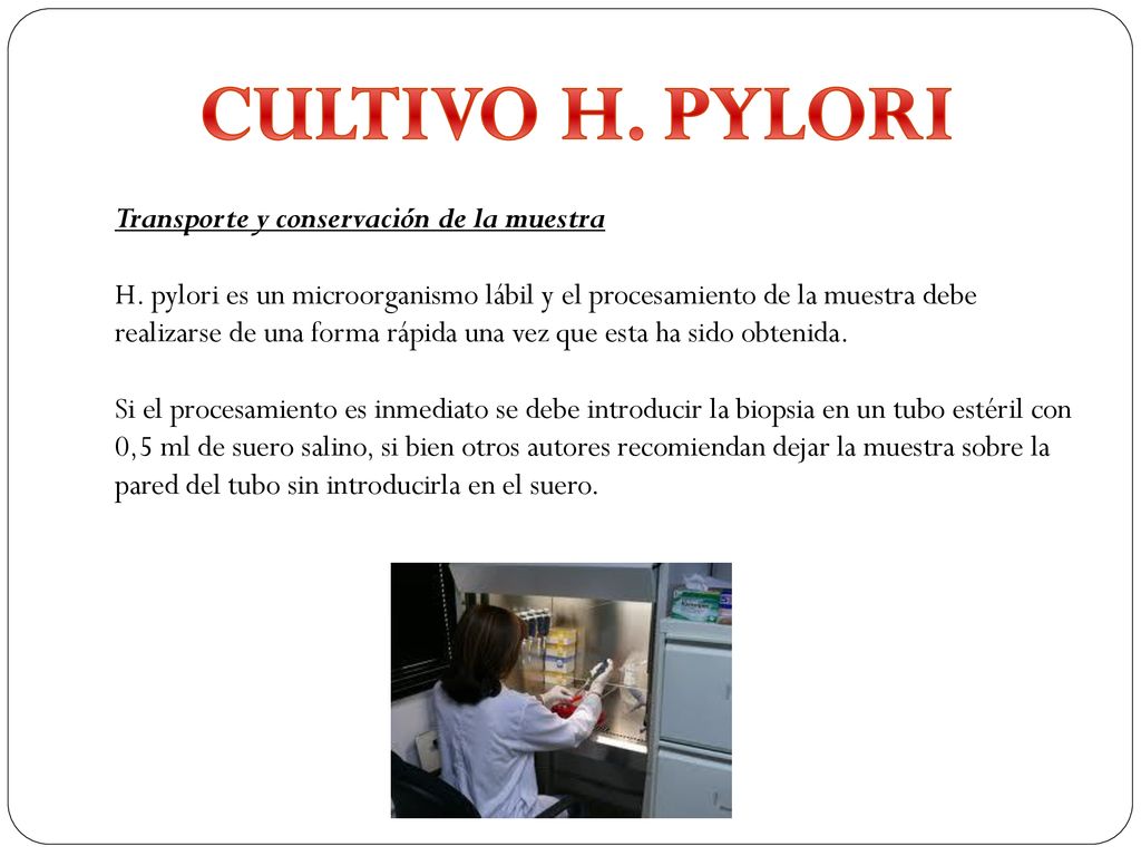 CULTIVO H. PYLORI Transporte y conservación de la muestra