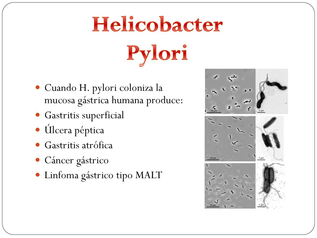Helicobacter Pylori Cuando H. pylori coloniza la mucosa gástrica humana produce: Gastritis superficial.