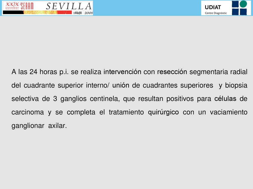 A las 24 horas p.i. se realiza intervención con resección segmentaria radial del cuadrante superior interno/ unión de cuadrantes superiores y biopsia selectiva de 3 ganglios centinela, que resultan positivos para células de carcinoma y se completa el tratamiento quirúrgico con un vaciamiento ganglionar axilar.