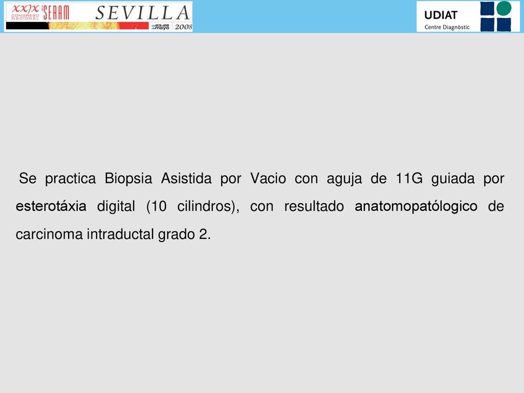 Se practica Biopsia Asistida por Vacio con aguja de 11G guiada por esterotáxia digital (10 cilindros), con resultado anatomopatólogico de carcinoma intraductal grado 2.
