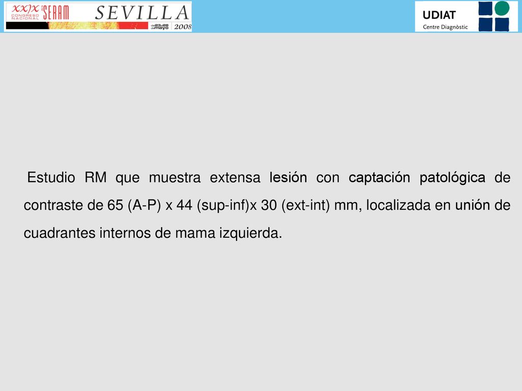 Estudio RM que muestra extensa lesión con captación patológica de contraste de 65 (A-P) x 44 (sup-inf)x 30 (ext-int) mm, localizada en unión de cuadrantes internos de mama izquierda.