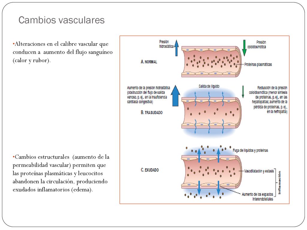 Cambios vasculares Alteraciones en el calibre vascular que conducen a aumento del flujo sanguíneo (calor y rubor).