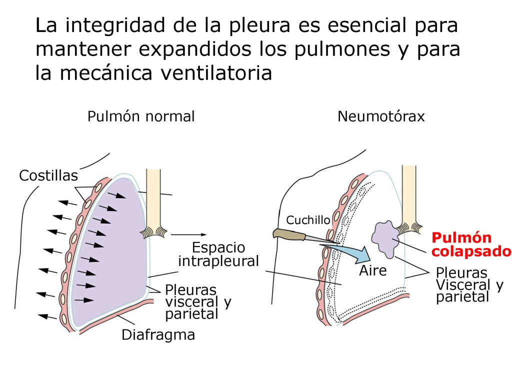 La integridad de la pleura es esencial para mantener expandidos los pulmones y para la mecánica ventilatoria