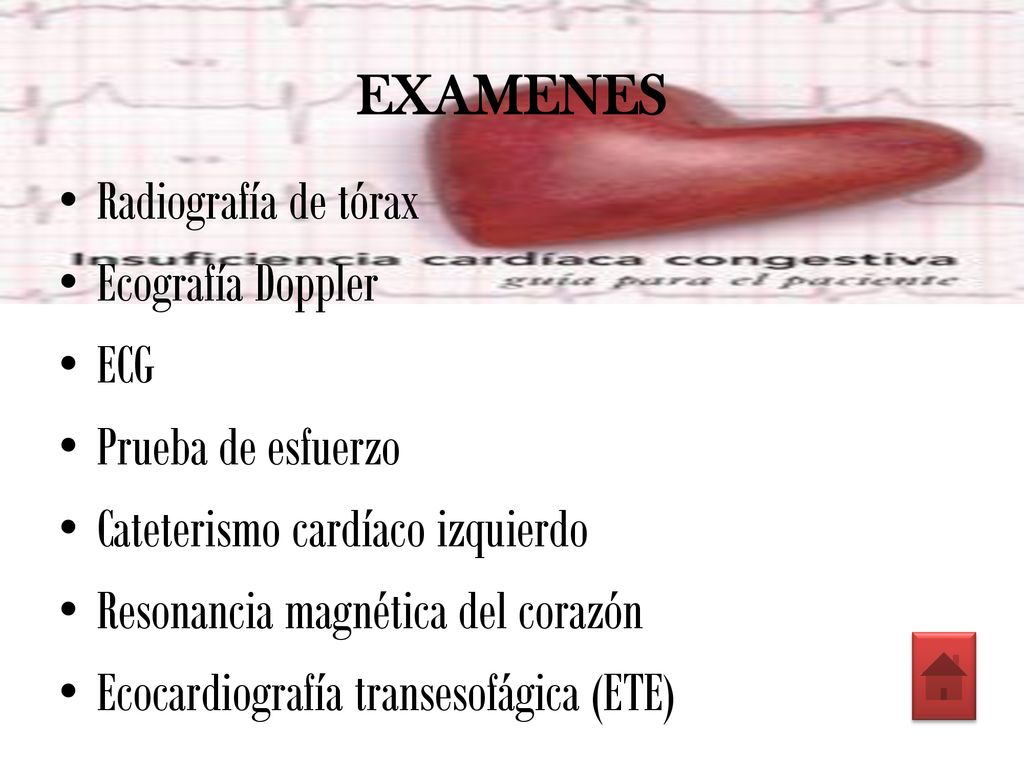 EXAMENES Radiografía de tórax. Ecografía Doppler. ECG. Prueba de esfuerzo. Cateterismo cardíaco izquierdo.