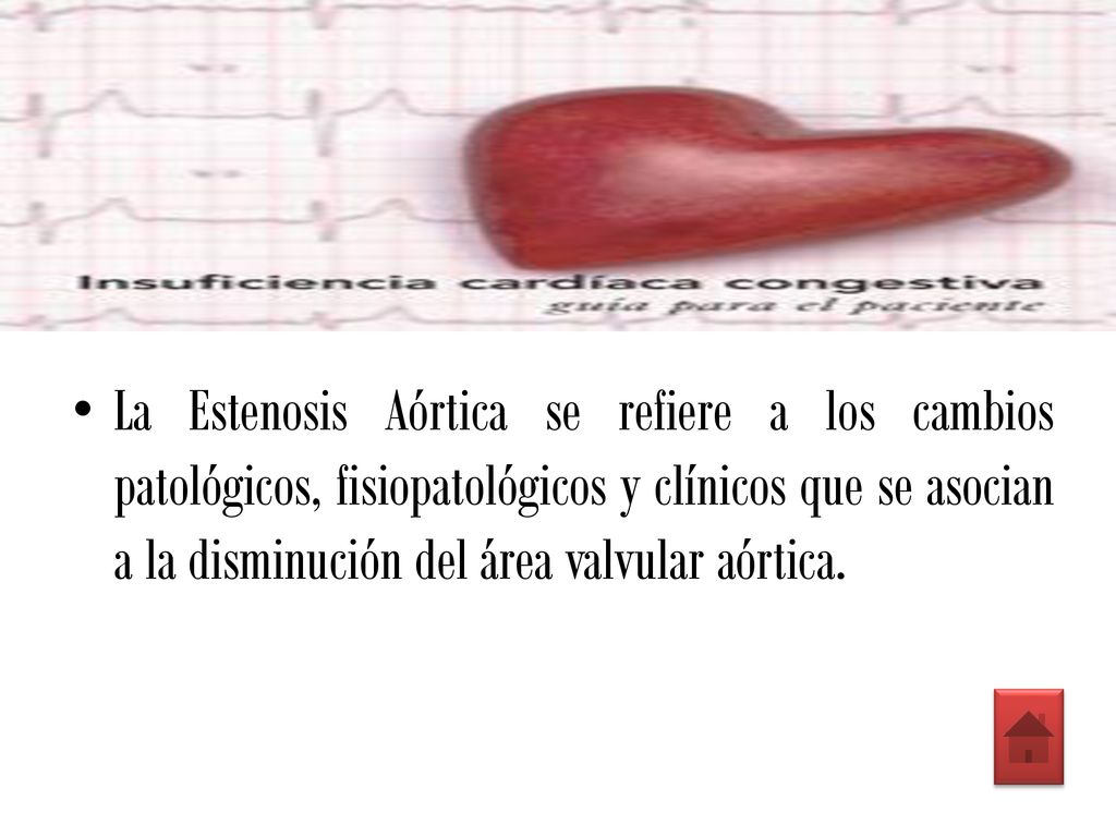 La Estenosis Aórtica se refiere a los cambios patológicos, fisiopatológicos y clínicos que se asocian a la disminución del área valvular aórtica.