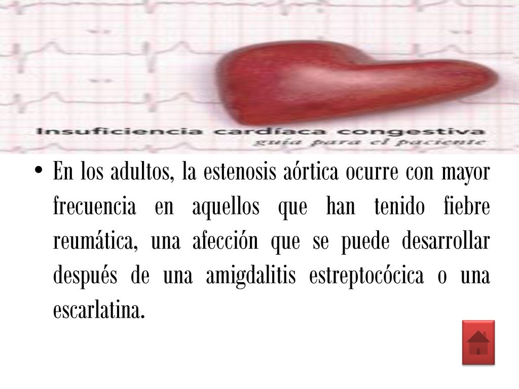 En los adultos, la estenosis aórtica ocurre con mayor frecuencia en aquellos que han tenido fiebre reumática, una afección que se puede desarrollar después de una amigdalitis estreptocócica o una escarlatina.