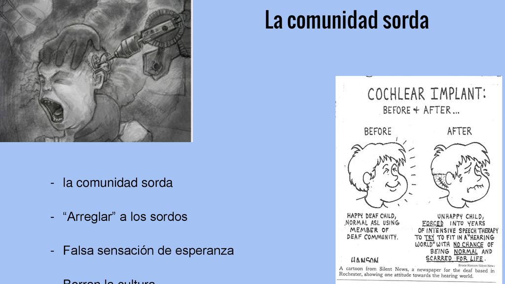 La comunidad sorda la comunidad sorda Arreglar a los sordos
